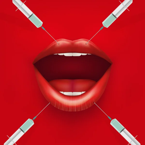 Vector illustration of a Botox injection.