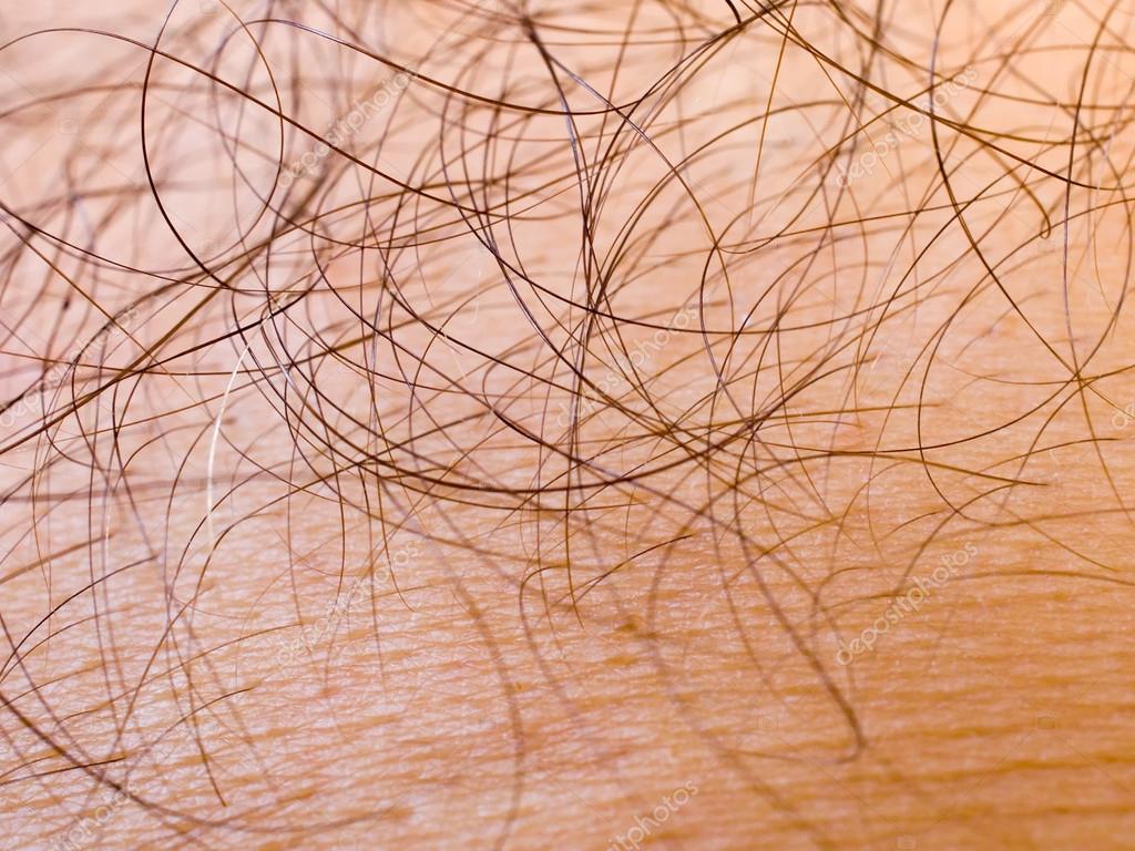 human skin background stock image image of melanoma 61054117 human skin closeup background stock photo 169 leonardi 12847635 human skin background stock image image of melanoma 61054117 human skin closeup background stock photo 169 leonardi 12847635