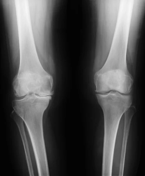 Orthostasis MRI: maintenance of an upright standing posture