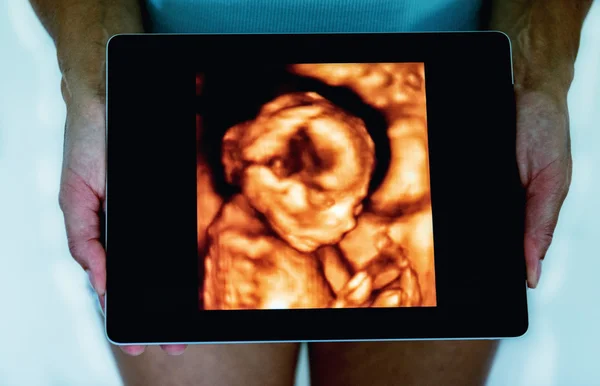 Woman with ultrasound image of baby