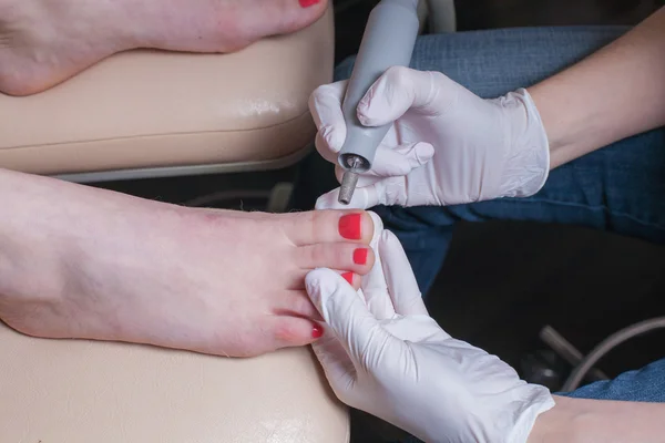 Peeling feet pedicure procedure