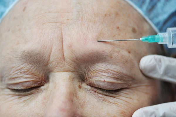 Aged female receiving botox injection in forehead