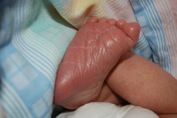 Tootsy newborn in the first minutes after birth