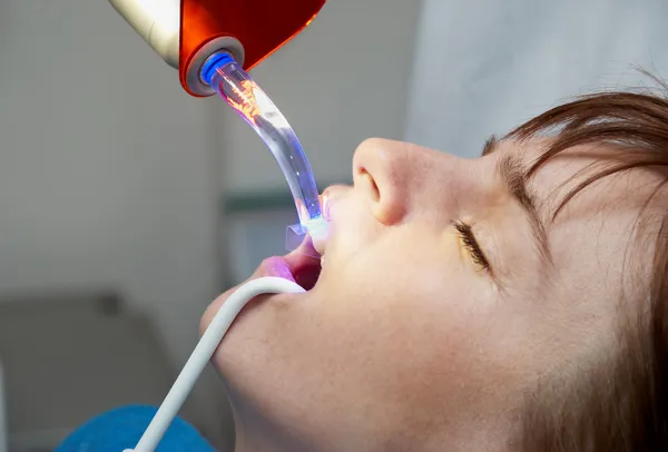 Dentist curing the patient's teeth with ultraviolet lamp