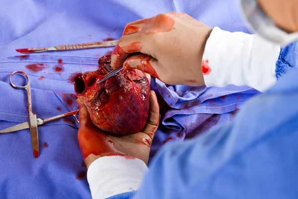 Doctor operating on patient heart