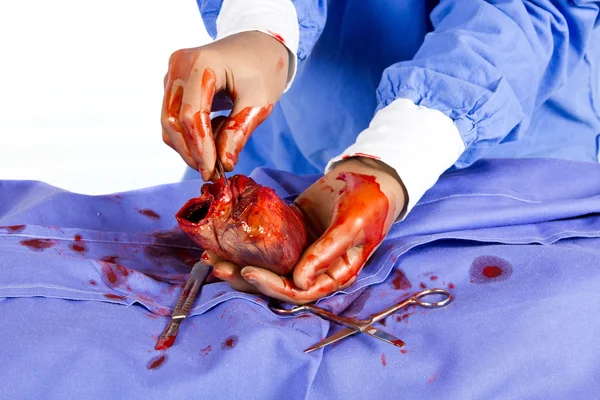 Doctor operating on patient heart