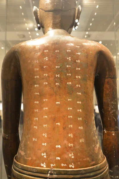 Acupuncture model of chinese medicine