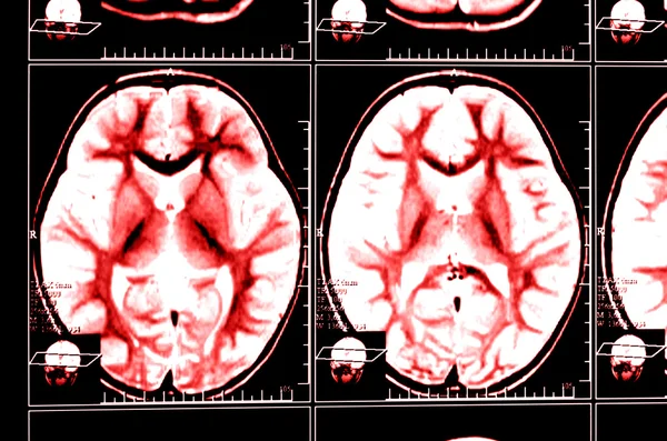 X-ray image of the brain computed tomography