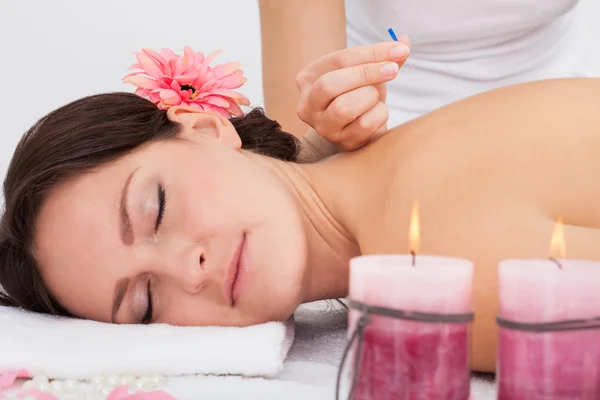 Woman Getting Acupuncture Therapy