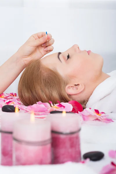 Woman Getting Acupuncture Treatment