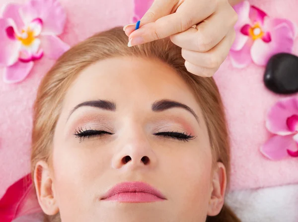 Woman Getting Acupuncture Treatment