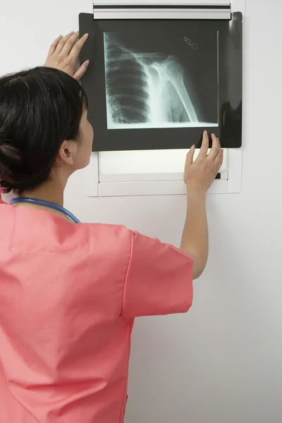 Female Doctor Examining X-Ray Report