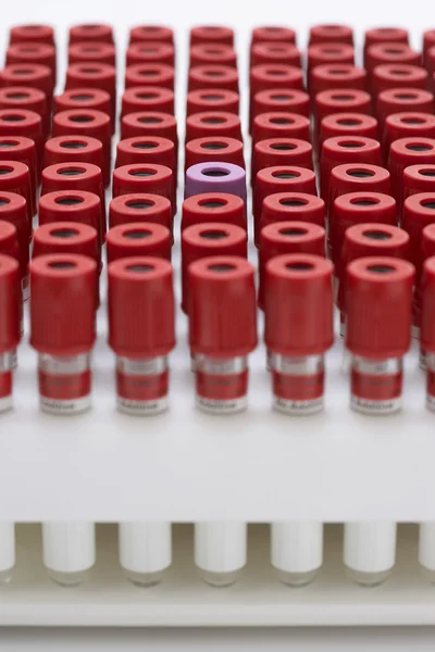 Test tubes with red lids