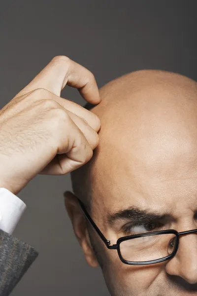 Bald businessman scratching head