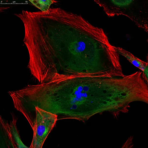 Fibroblasts (skin cells) labeled with fluorescent dyes