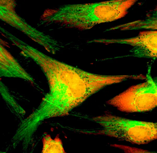 Fibroblasts (skin  cells) labeled with fluorescent dyes