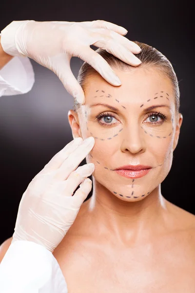 Doctor preparing middle aged woman for face lifting surgery