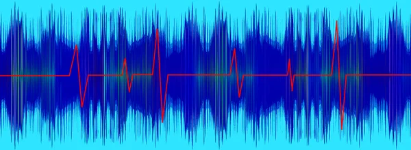 Heratbeet red line on turquoise electrocardiogram screen.