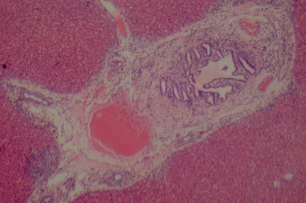 Microscopic section of human liver