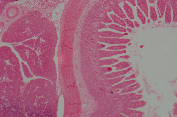 Microscopic section of human small intestinum tenue tissue