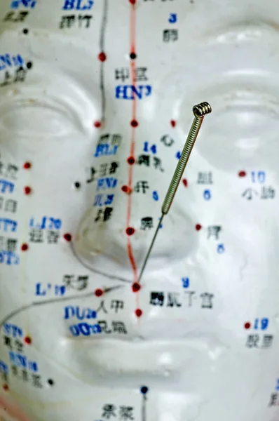 Acupuncture needle on head model