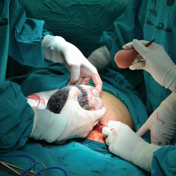 Cesarean section