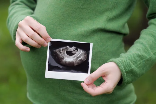 Ultrasound photographs of pregnancy
