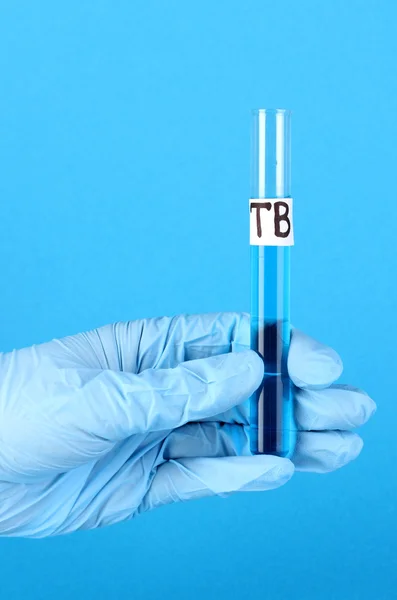 Test tube labeled Tuberculosis(TB) in hand on blue background
