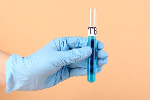 Test tube labeled Tuberculosis(TB) in hand on beige background