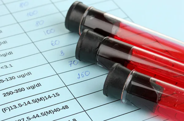 Blood in test tubes and results close up