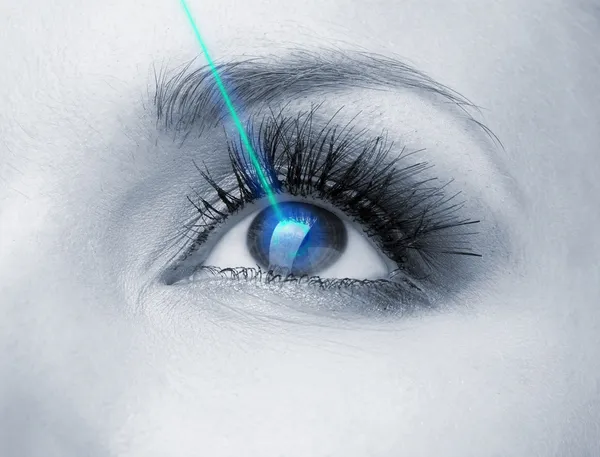 Laser vision correction. Woman's eye.