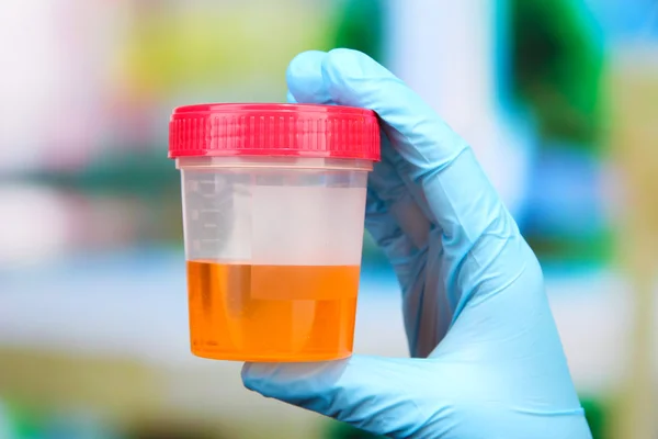 Medical urine test, close-up