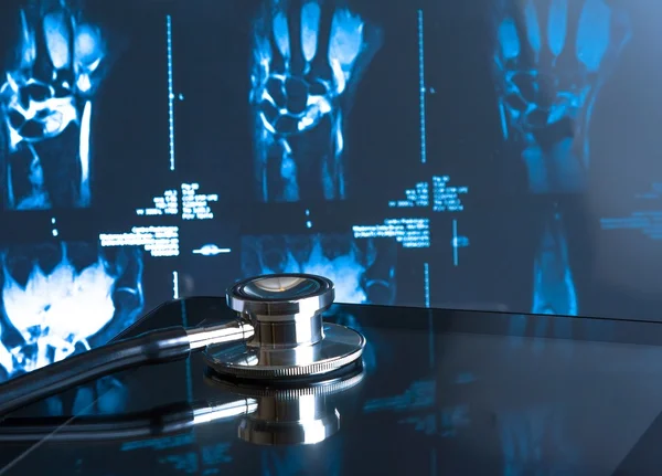Medical stethoscope on modern digital tablet pc in laboratory on x-ray images background