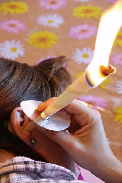 Young woman uses cones of wax to clean ear wax