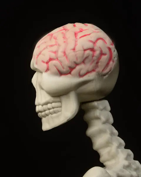 Skull with Brain
