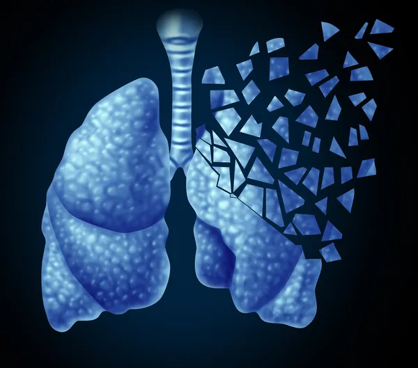 Lung Illness