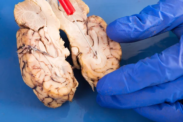 Cross-section of a cow brain