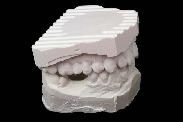 Dental impression chalk model