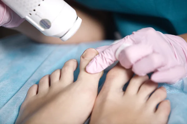 Woman receiving laser treatment on her feet