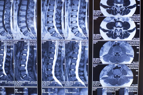 X-ray photograph of human organs