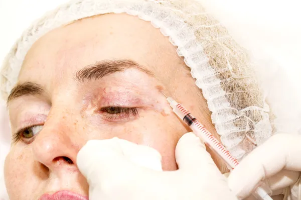 Cosmetic treatment with botox injection