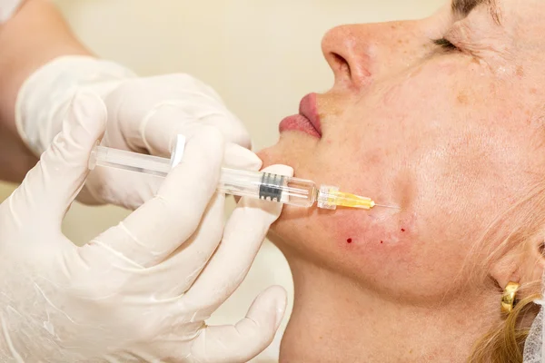 Cosmetic treatment with botox injection