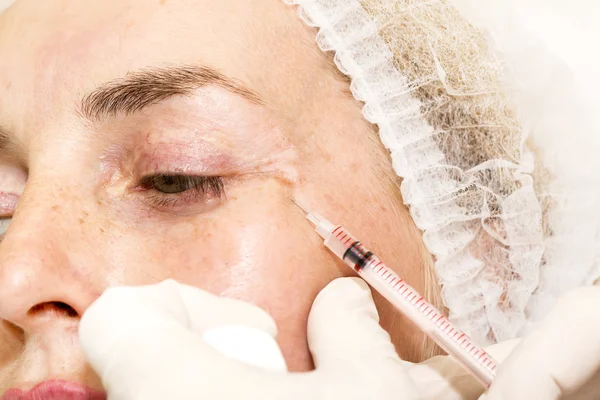 Cosmetic treatment with botox injection