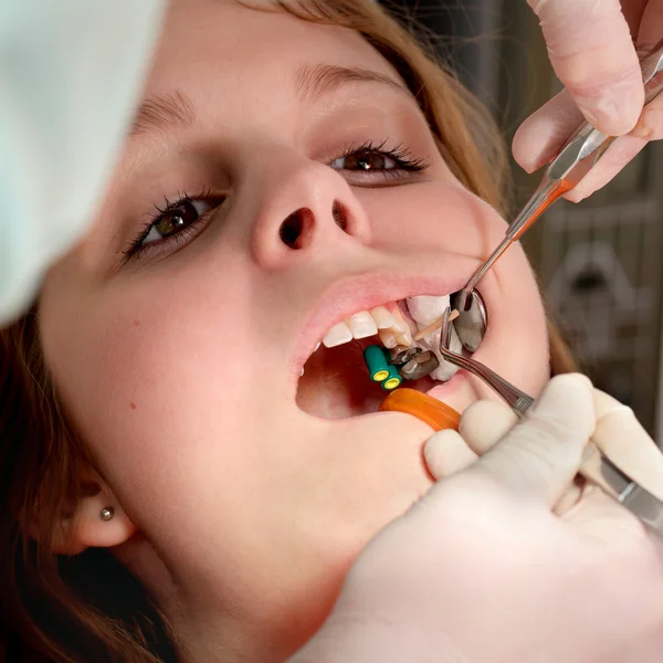 Dental procedure, drilling and filling tooth Stock Image Everypixel