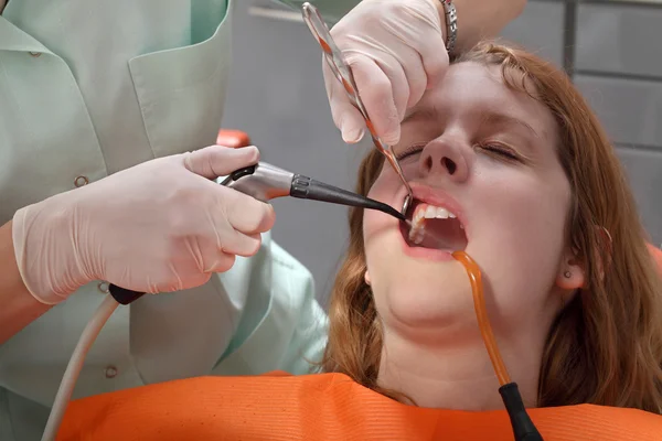 Dental procedure, splashing tooth