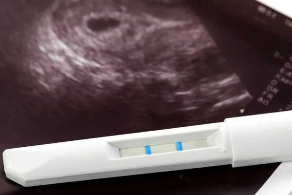 Pregnancy test and ultrasound mother\'s womb