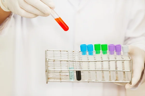 Hand of a scientific taking a blood sample tube