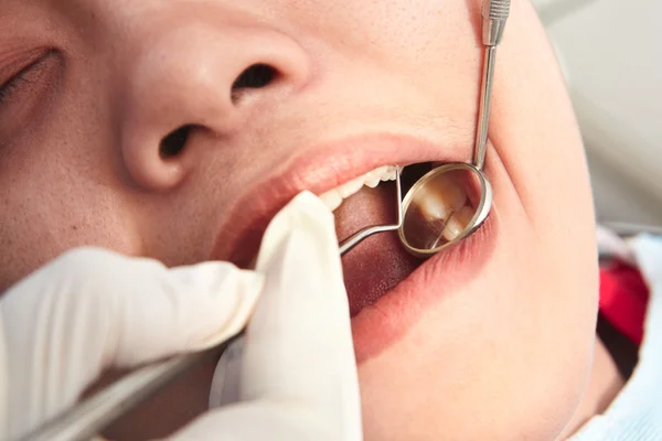 Close up teeth examination