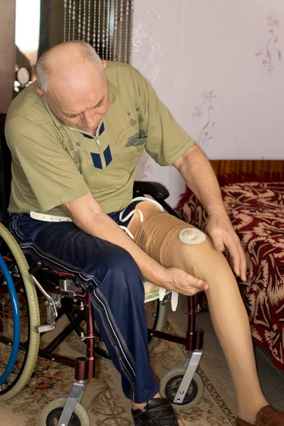 Senior man fitting a prosthetic leg