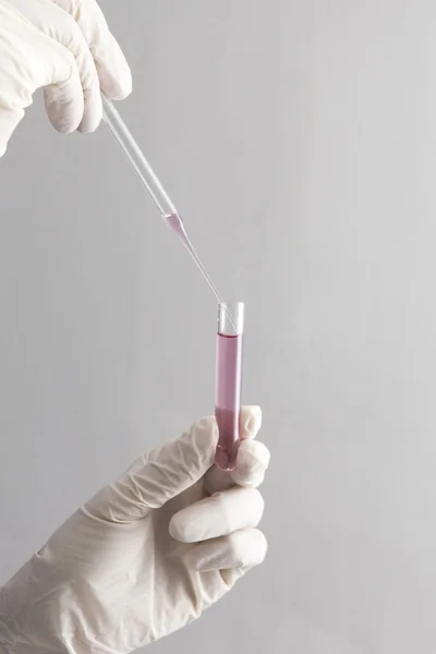Hand holding a test-tube with ping liquid